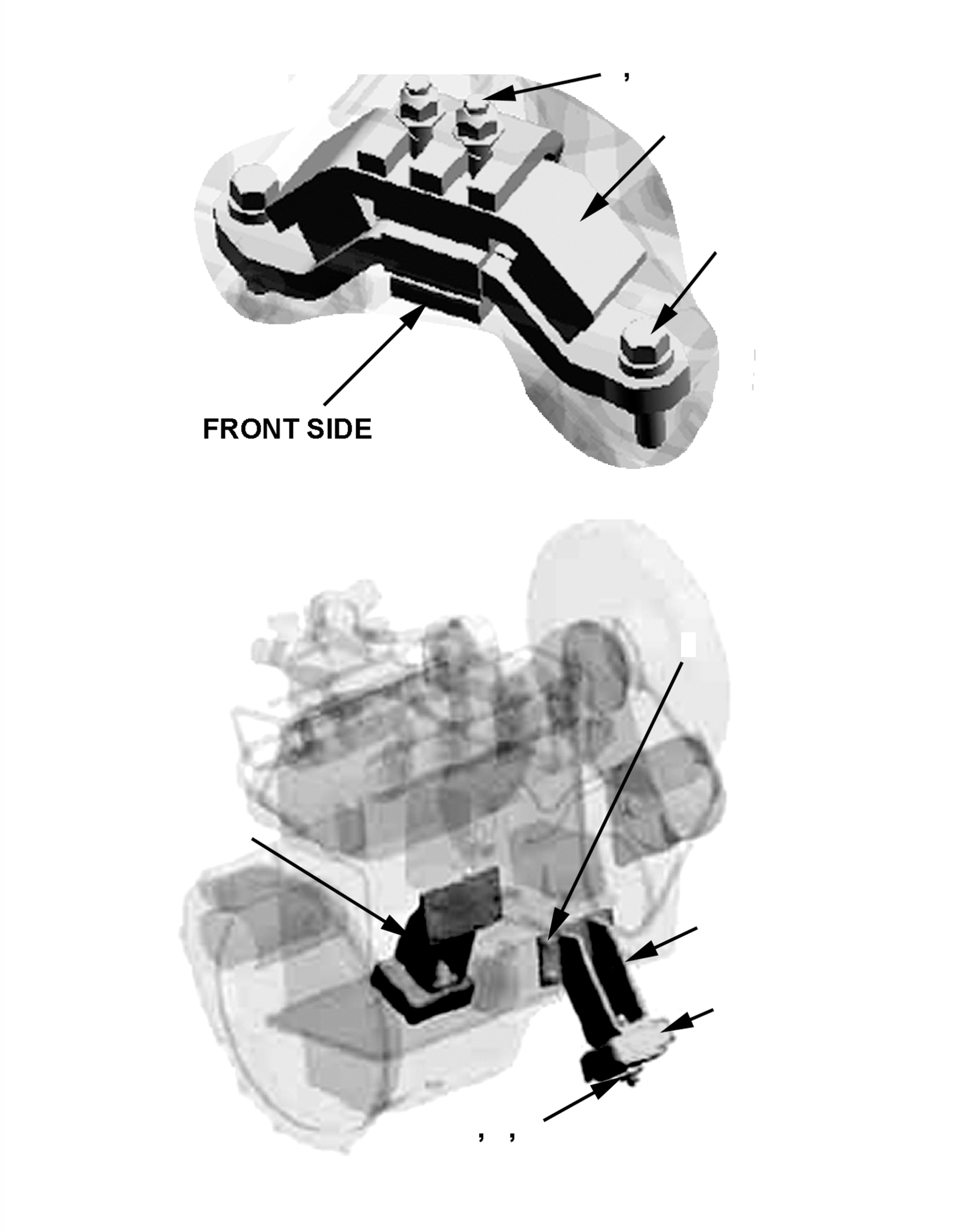 BRACKET, LH 3EB-02-52111 KOMATSU